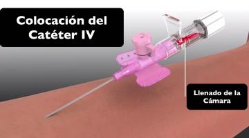 Catéter IV