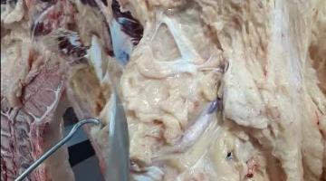 Inguinal_Retromamario